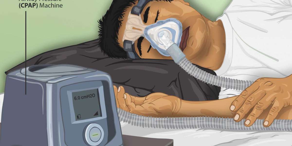 Continuous Positive Airway Pressure (CPAP) Interface Devices Market