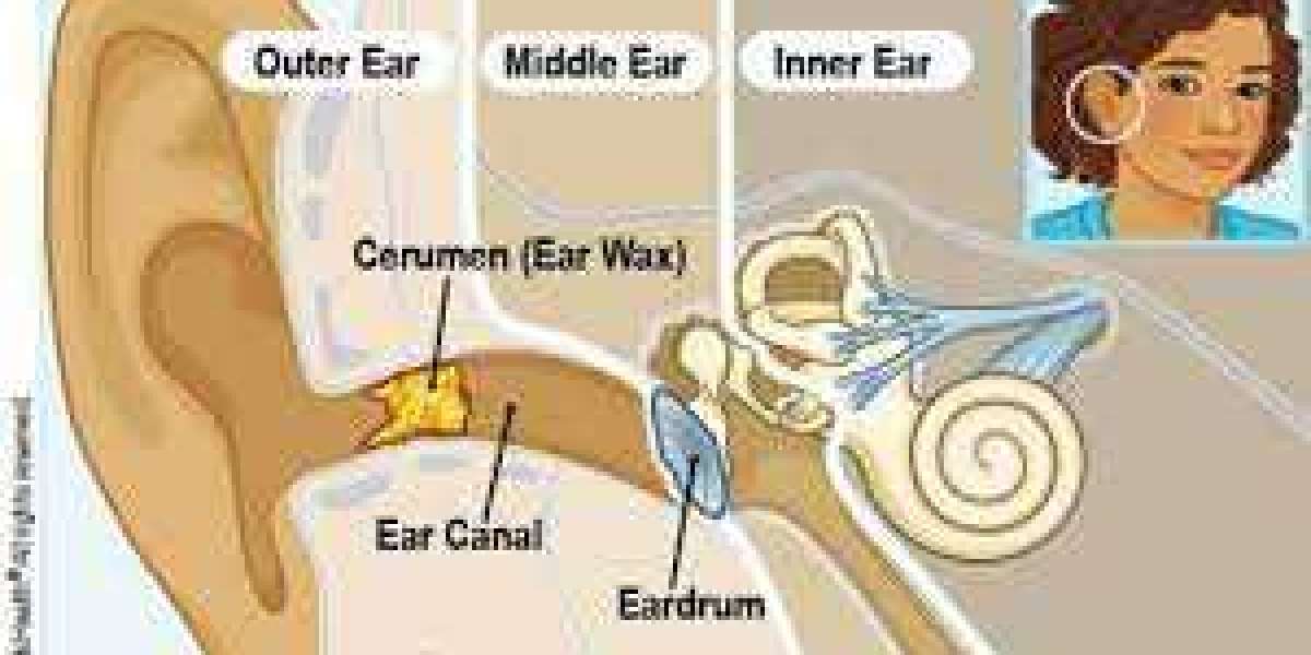 Emergency Ear Wax Removal