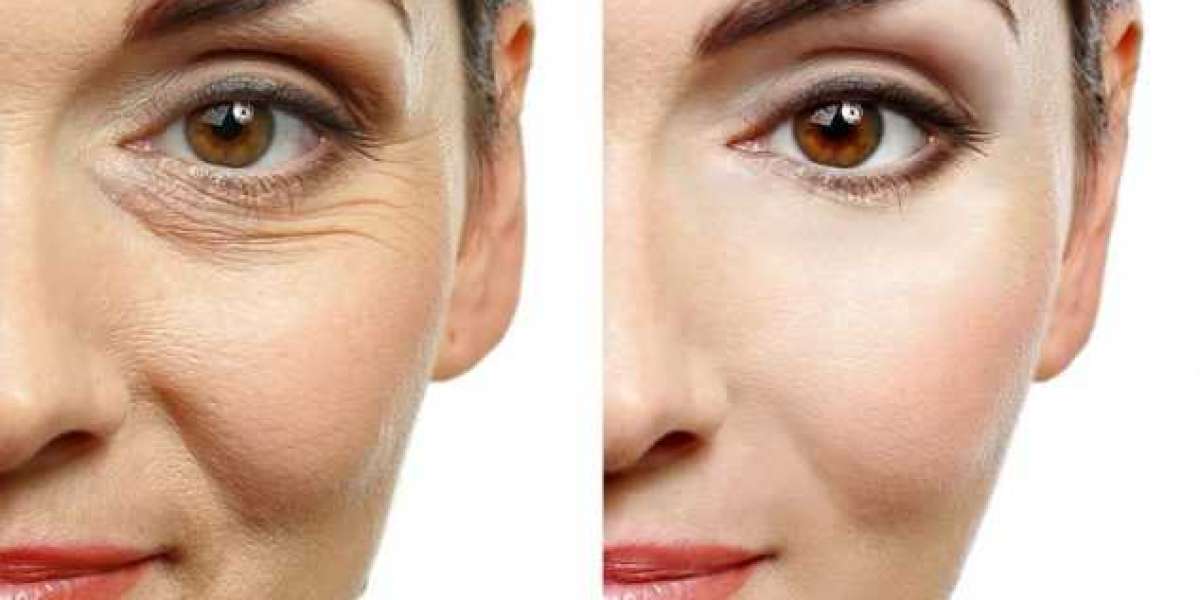 The Art of Cosmetic Surgery: Plastic Surgery & Botox in Delhi